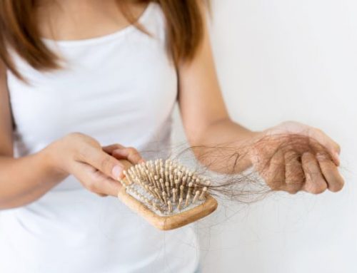 How to Treat Hair Loss